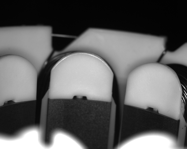 机器视觉字符缺陷检测